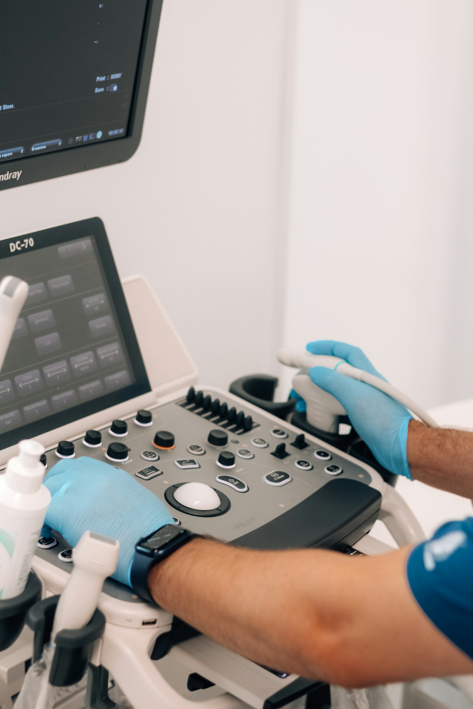 A male doctor wearing a white lab coat examines a X Ray image in a medical facility. She is holding the scan up to the light while analyzing the details.