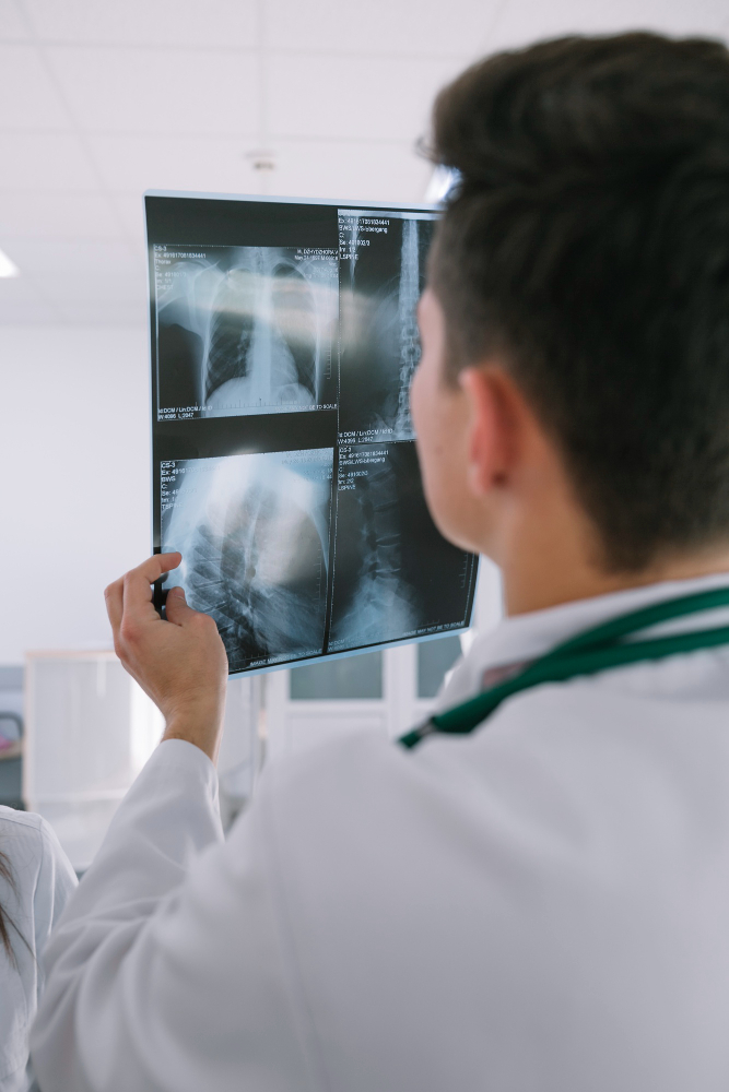 A male doctor wearing a white lab coat examines a X Ray image in a medical facility. She is holding the scan up to the light while analyzing the details.