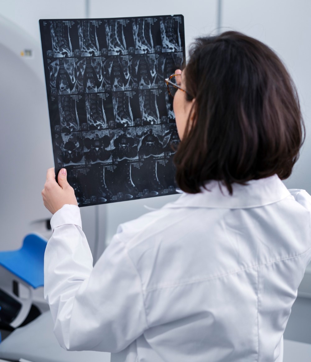 A female doctor wearing a white lab coat examines a X Ray image in a medical facility. She is holding the scan up to the light while analyzing the details.